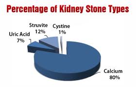 types of kidney stones